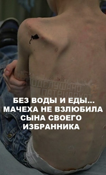 Любовь приемной матери это голод, побои и грязный изношенный подгузник Мальчик, взятый ради денег из пособия ласки не знал, он жил в сарае на веревке. Иногда шмать ему кидала корку хлеба, но